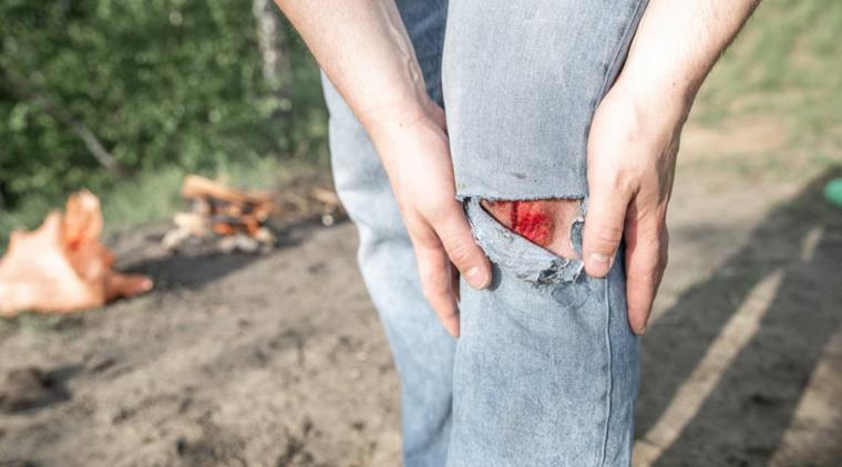 Mand med ødelagte bukser og sår på knæet